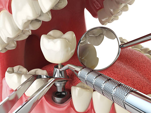 Best Cracked Tooth Emergency Dentist  in Watauga, TX